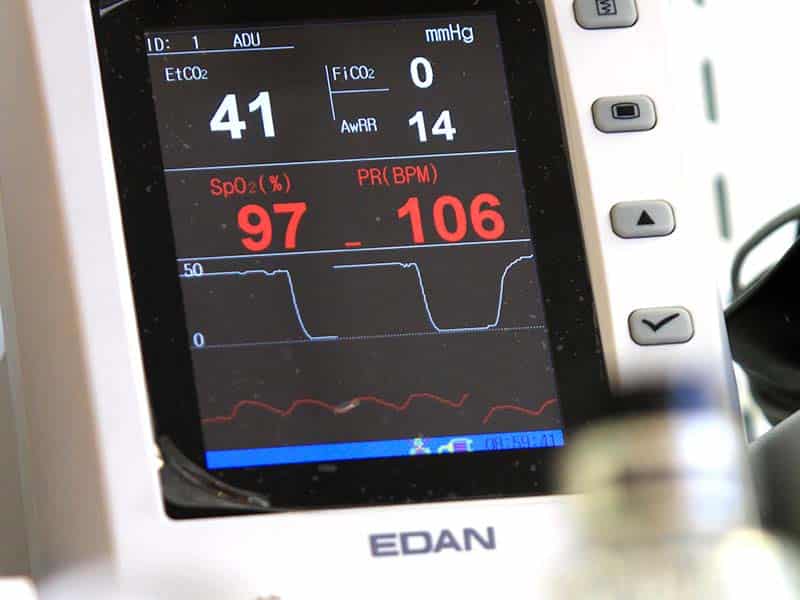 Monitoring anesthésique Nous utilisons un appareil de monitoring anesthésique à la clinique